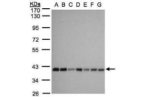 Image no. 2 for anti-Solute Carrier Family 25, Member 33 (SLC25A33) (Center) antibody (ABIN2856433)