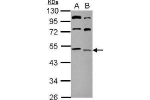 WB Image Sample (20 ug of whole cell lysate) A: HeLa B: HeLa membrane 10% SDS PAGE antibody diluted at 1:500