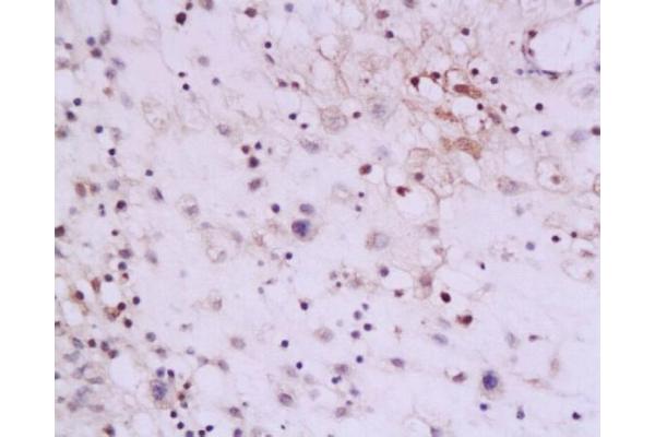 IL-13 antibody  (AA 45-56)