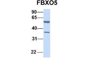 Image no. 3 for anti-F-Box Protein 5 (FBXO5) (C-Term) antibody (ABIN2774700)