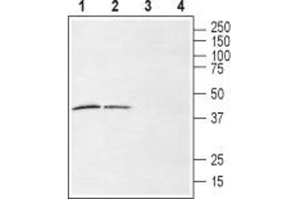 anti-Lysophosphatidic Acid Receptor 6 (LPAR6) (2nd Extracellular Loop), (AA 156-168) antibody