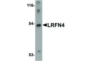 Image no. 1 for anti-Leucine Rich Repeat and Fibronectin Type III Domain Containing 4 (LRFN4) (C-Term) antibody (ABIN6657065)
