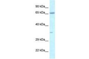 Image no. 1 for anti-Leucine Zipper, Putative Tumor Suppressor 1 (LZTS1) (AA 530-579) antibody (ABIN6747423)