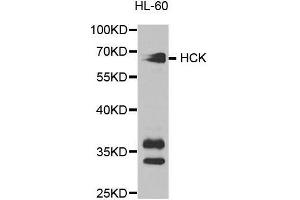 Image no. 1 for anti-Hemopoietic Cell Kinase (HCK) antibody (ABIN3022864)