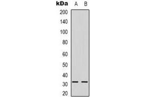 Image no. 1 for anti-Nerve Growth Factor beta (NGFB) antibody (ABIN2801161)