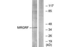 Image no. 1 for anti-MAS-Related GPR, Member F (Mrgprf) (AA 271-320) antibody (ABIN1535775)