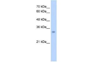 Image no. 1 for anti-Enoyl Coenzyme A Hydratase 1, Peroxisomal (ECH1) (N-Term) antibody (ABIN2781318)