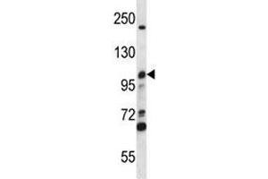 Image no. 2 for anti-Minichromosome Maintenance Deficient 4 (MCM4) (AA 637-665) antibody (ABIN3031812)