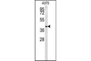 Image no. 2 for anti-Solute Carrier Family 35, Member B2 (SLC35B2) (AA 400-429), (C-Term) antibody (ABIN954822)