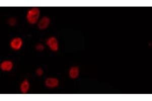 Image no. 2 for anti-Elongation Factor RNA Polymerase II (ELL) antibody (ABIN6257163)