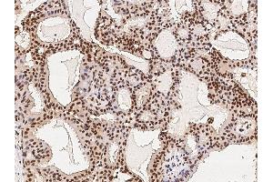 Image no. 2 for anti-Histone Deacetylase 11 (HDAC11) (N-Term) antibody (ABIN6925793)