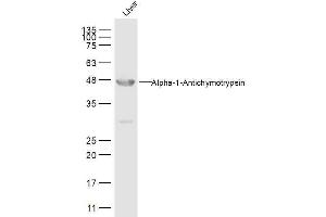 Liver lysates probed withAACT Alpha1 Polyclonal Antibody, Unconjugated  at 1:500 dilution and 4˚C overnight incubation.