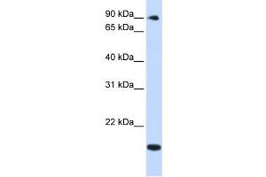 Image no. 1 for anti-TSR1, 20S rRNA Accumulation, Homolog (TSR1) (Middle Region) antibody (ABIN2782565)