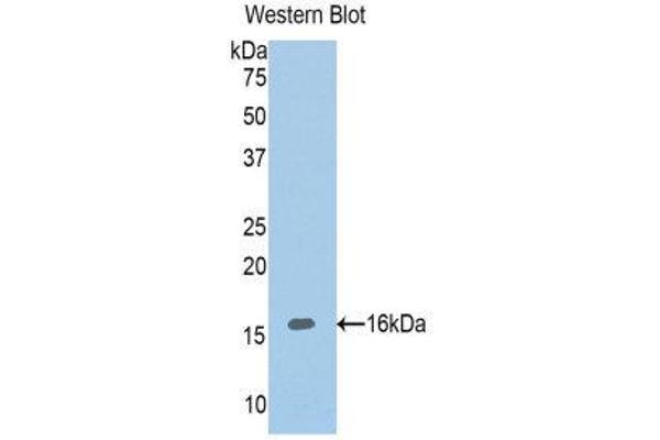 anti-ADAM Metallopeptidase with Thrombospondin Type 1 Motif, 1 (ADAMTS1) (AA 854-967) antibody