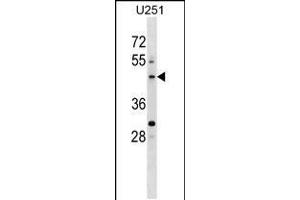 PLEKHO2 anticorps  (N-Term)