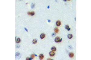 Image no. 3 for anti-Cell Division Cycle Associated 4 (CDCA4) (Center) antibody (ABIN2972927)