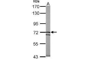 Image no. 2 for anti-Solute Carrier Family 25, Member 13 (Citrin) (slc25a13) (Internal Region) antibody (ABIN2856647)