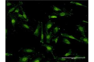 Immunofluorescence of monoclonal antibody to RNF40 on HeLa cell.