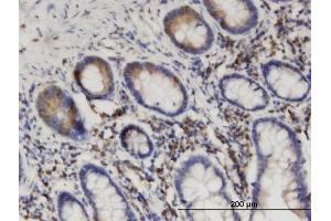 Immunoperoxidase of monoclonal antibody to SEPT8 on formalin-fixed paraffin-embedded human small Intestine.