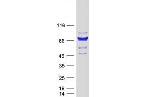 Image no. 1 for SAM Domain and HD Domain 1 (SAMHD1) protein (Myc-DYKDDDDK Tag) (ABIN2731377)