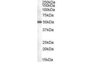 Image no. 1 for anti-CDK5 Regulatory Subunit Associated Protein 3 (CDK5RAP3) (C-Term) antibody (ABIN2774329)