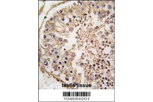 Image no. 1 for anti-B-Cell CLL/lymphoma 2 (BCL2) (AA 75-110) antibody (ABIN388095)