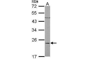 Image no. 4 for anti-Ras Homolog Gene Family, Member C (RHOC) (Center) antibody (ABIN2854791)