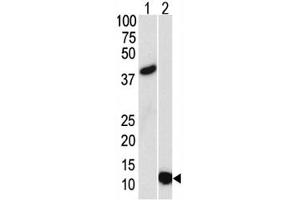 Image no. 2 for anti-Small Ubiquitin Related Modifier 3 (SUMO3) antibody (ABIN3029017)