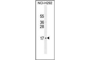 Western blot analysis of LLPH Antibody (Center) in NCI-H292 cell line lysates (35ug/lane).