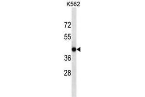 Image no. 1 for anti-Calcium Channel, Voltage-Dependent, gamma Subunit 4 (CACNG4) (AA 154-183), (Middle Region) antibody (ABIN950995)