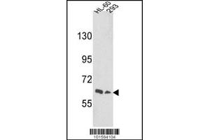Western Blotting (WB) image for anti-EPH Receptor A3 (EPHA3) antibody (ABIN2158717)