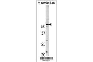Image no. 1 for anti-Cyclin-Dependent Kinase 14 (CDK14) (AA 1-30), (N-Term) antibody (ABIN391791)