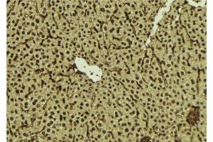 Image no. 1 for anti-Fanconi Anemia, Complementation Group C (FANCC) antibody (ABIN6261673)