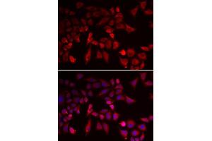 Immunofluorescence analysis of MCF-7 cells using PYGL antibody.
