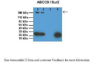 Image no. 2 for anti-ATP-Binding Cassette, Sub-Family C (CFTR/MRP), Member 9 (ABCC9) (Middle Region) antibody (ABIN2781513)