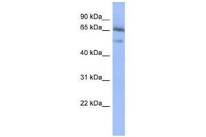 Image no. 1 for anti-Nuclear Factor of kappa Light Polypeptide Gene Enhancer in B-Cells Inhibitor, epsilon (NFKBIE) (Middle Region) antibody (ABIN927719)