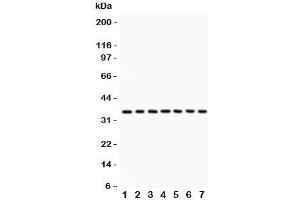 Image no. 4 for anti-Protein Phosphatase 2A Activator, Regulatory Subunit 4 (PPP2R4) (AA 1-309) antibody (ABIN3032389)