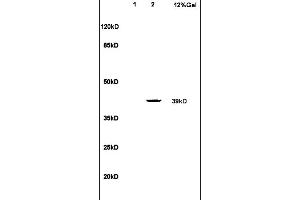 Image no. 1 for anti-Leukotriene B4 Receptor (LTB4R) (AA 101-200) antibody (ABIN748628)