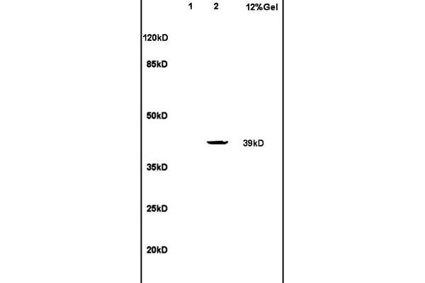 Leukotriene B4 Receptor/BLT antibody  (AA 101-200)