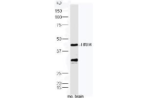 Image no. 1 for anti-Histamine Receptor H4 (HRH4) (AA 101-200) antibody (ABIN2690159)
