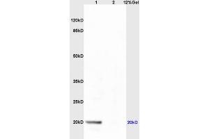 Image no. 2 for anti-Deoxyuridine Triphosphatase (DUT) (AA 151-252) antibody (ABIN733478)