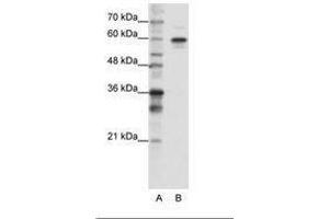 Image no. 3 for anti-Heterogeneous Nuclear Ribonucleoprotein L-Like (HNRPLL) (AA 24-73) antibody (ABIN202737)