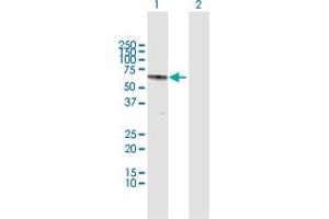 Image no. 3 for anti-Recombination Activating Gene 2 (RAG2) (AA 1-527) antibody (ABIN950151)