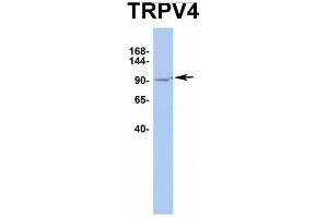 Image no. 3 for anti-Transient Receptor Potential Cation Channel, Subfamily V, Member 4 (TRPV4) (Middle Region) antibody (ABIN2776284)