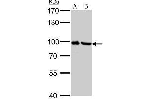 Image no. 5 for anti-Plasminogen (PLG) (Center) antibody (ABIN2855505)