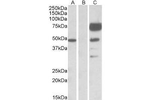 Image no. 1 for anti-Angiopoietin 1 (ANGPT1) (Internal Region) antibody (ABIN768552)