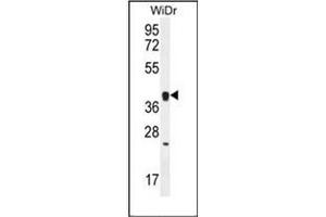 OR2T8 antibody  (C-Term)