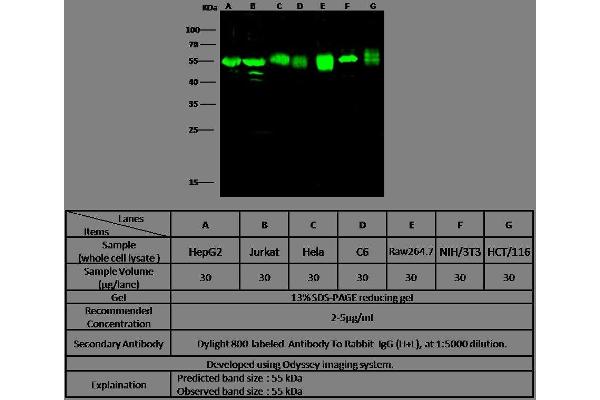 anti-Adenylosuccinate Lyase (ADSL) (AA 1-484) antibody