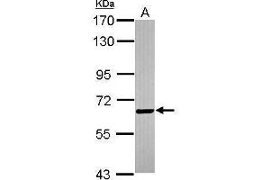 Image no. 1 for anti-Biotinidase (BTD) (Center) antibody (ABIN2856021)