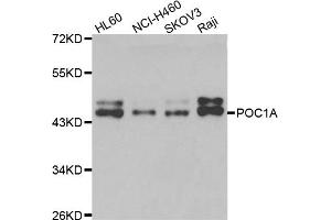Image no. 1 for anti-POC1 Centriolar Protein Homolog A (POC1A) antibody (ABIN6571159)